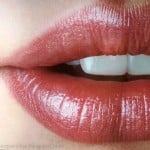 perfect-lips-with-lip-injection